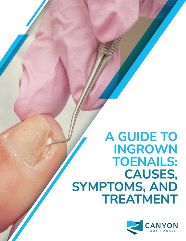 A Guide to Ingrown Toenails: Causes, Symptoms, and Treatment