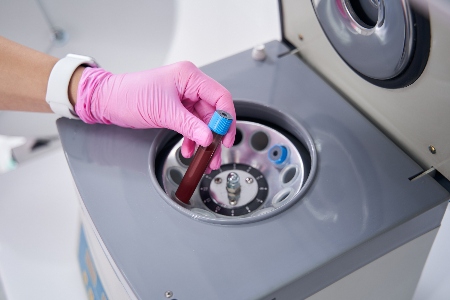 PRP Treatment